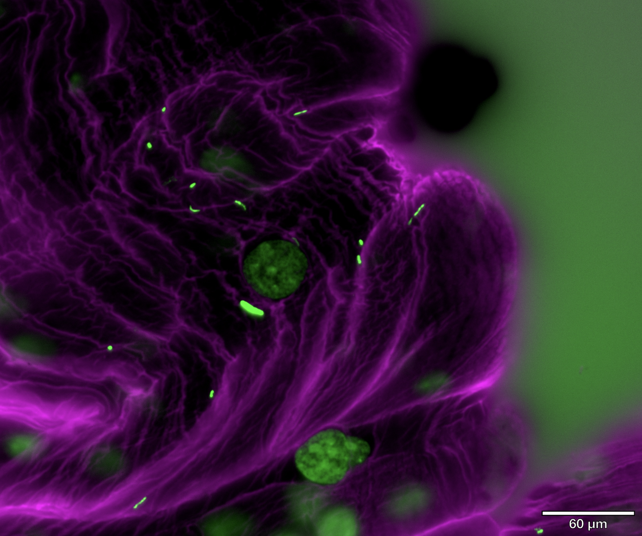 Midgut with bacteria