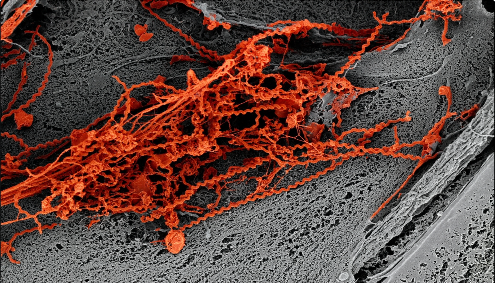 Leptospira skin microscopy