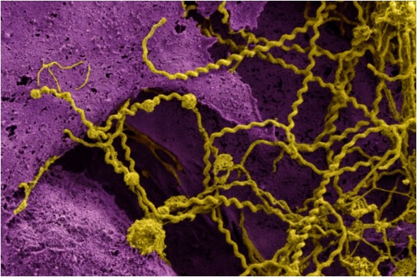 Leptospira skin microscopy